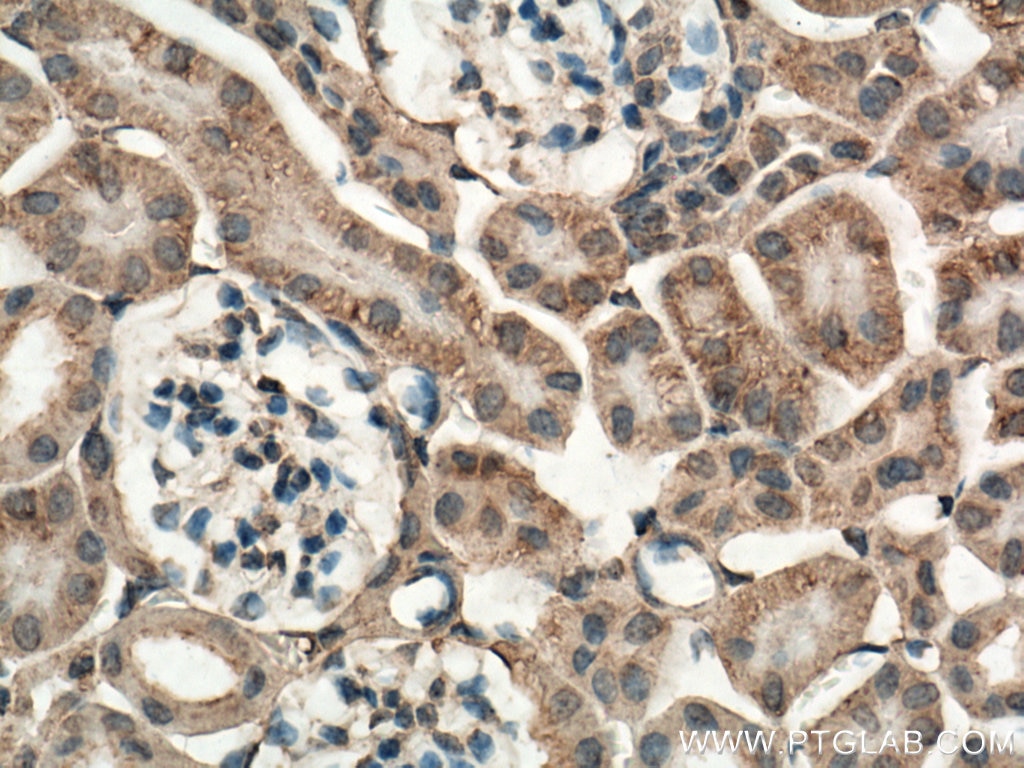 Immunohistochemistry (IHC) staining of mouse kidney tissue using Caspase 3/p17/p19 Monoclonal antibody (66470-2-Ig)