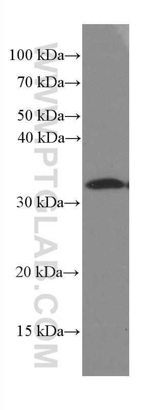 Western Blot (WB) analysis of HEK-293 cells using Caspase 3/p17/p19 Monoclonal antibody (66470-2-Ig)