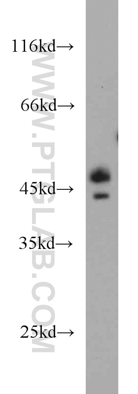 Western Blot (WB) analysis of SGC-7901 cells using Caspase 4/p20/p10 Polyclonal antibody (11856-1-AP)