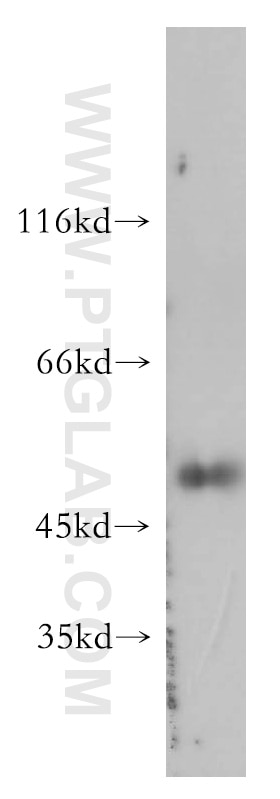 Western Blot (WB) analysis of SGC-7901 cells using Caspase 4/p20/p10 Polyclonal antibody (11856-1-AP)