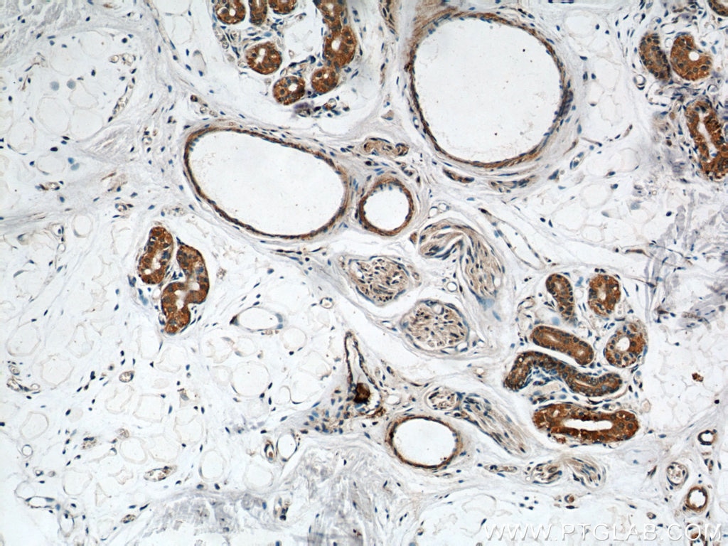 Caspase 6/p18/p11