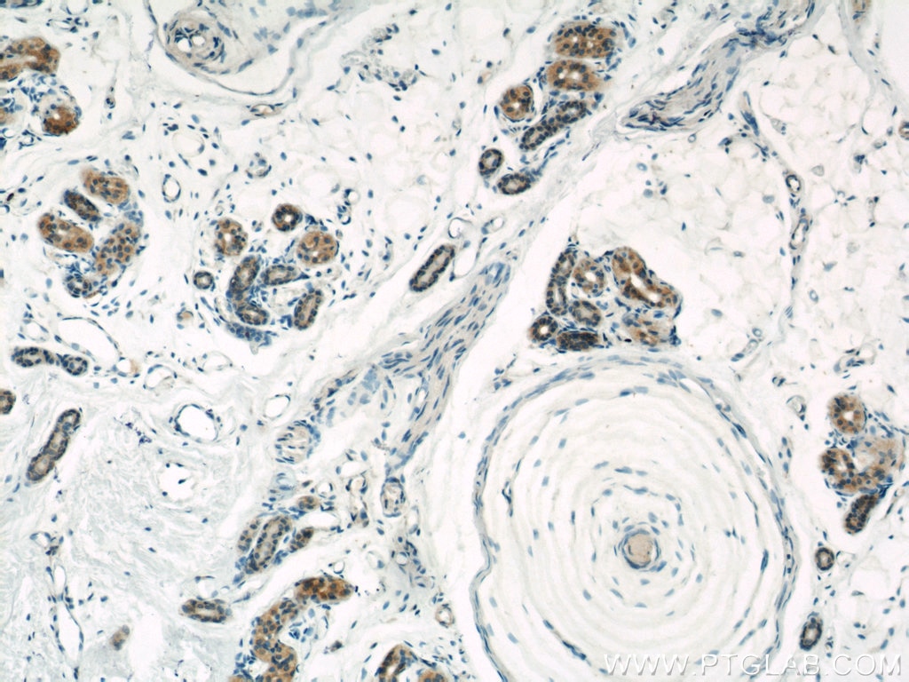 Immunohistochemistry (IHC) staining of human skin tissue using Caspase 6/p18/p11 Polyclonal antibody (10198-1-AP)