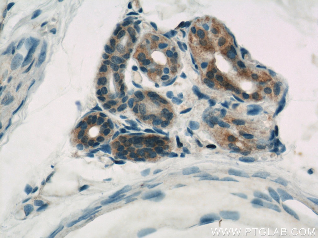 IHC staining of human skin using 10198-1-AP