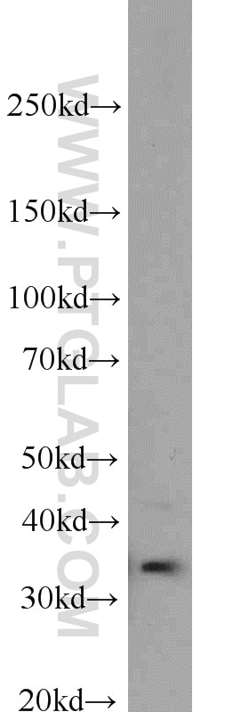 Western Blot (WB) analysis of Jurkat cells using Caspase 6/p18/p11 Polyclonal antibody (10198-1-AP)