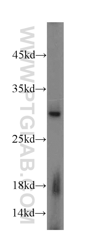 Western Blot (WB) analysis of mouse brain tissue using Caspase 6/p18/p11 Polyclonal antibody (10198-1-AP)