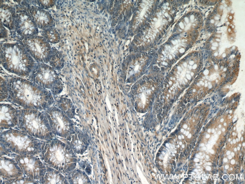 Immunohistochemistry (IHC) staining of human colon tissue using Caspase 8/p43/p18 Polyclonal antibody (13423-1-AP)