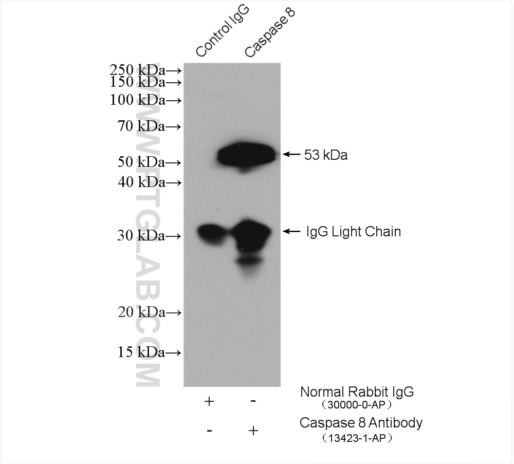 Immunoprecipitation (IP) experiment of Jurkat cells using Caspase 8/p43/p18 Polyclonal antibody (13423-1-AP)