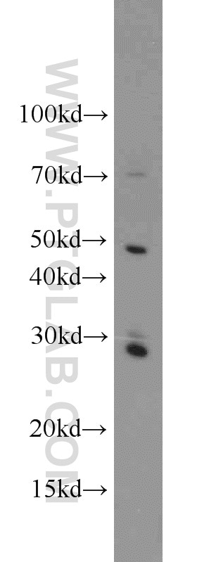Western Blot (WB) analysis of RAW264.7 using Caspase 8/p43/p18 Polyclonal antibody (13423-1-AP)