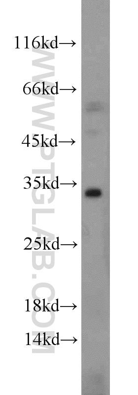 Western Blot (WB) analysis of Raji cells using Caspase 8/p43/p18 Polyclonal antibody (13423-1-AP)