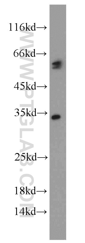 Caspase 8/p43/p18 Polyclonal antibody