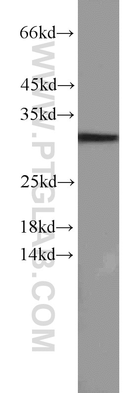 Western Blot (WB) analysis of HeLa cells using Caspase 8/p43/p18 Polyclonal antibody (13423-1-AP)