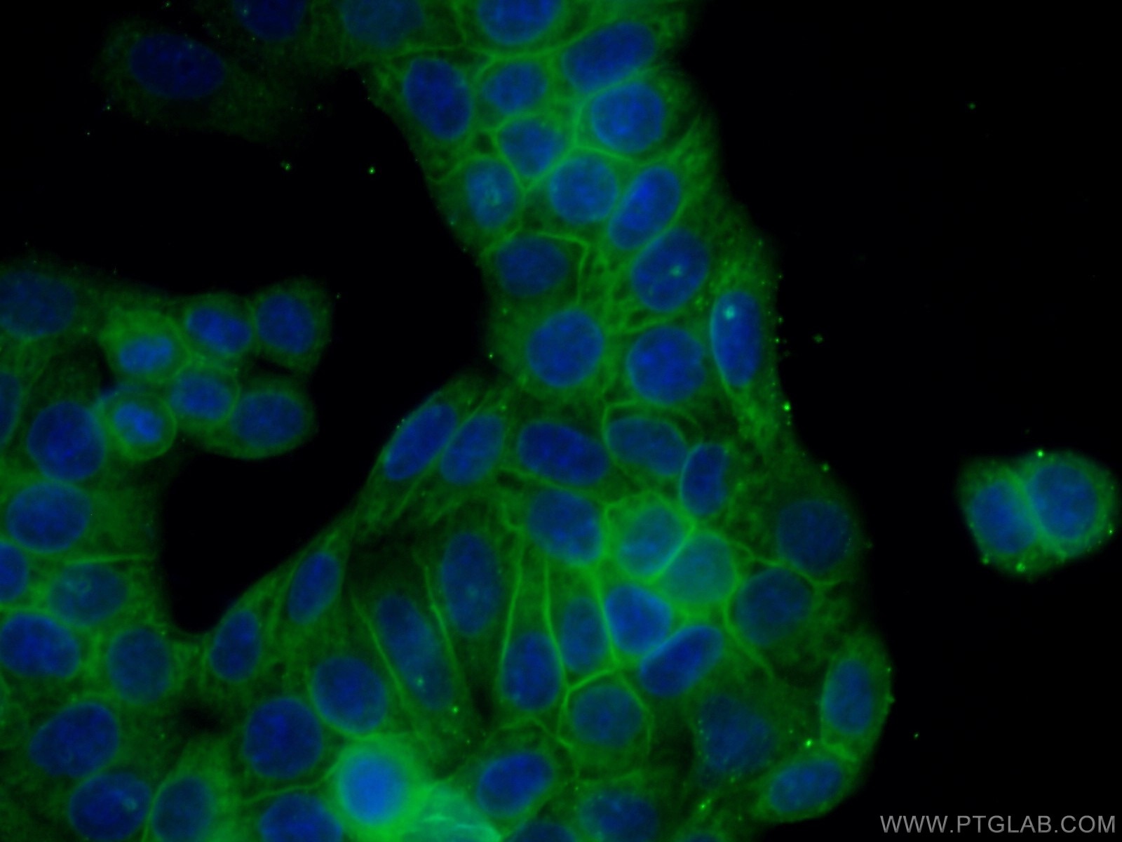 Immunofluorescence (IF) / fluorescent staining of HeLa cells using Caspase 8/p43/p18 Monoclonal antibody (66093-1-Ig)