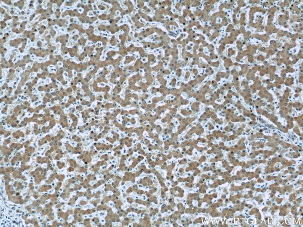 Immunohistochemistry (IHC) staining of human liver tissue using Caspase 8/p43/p18 Monoclonal antibody (66093-1-Ig)