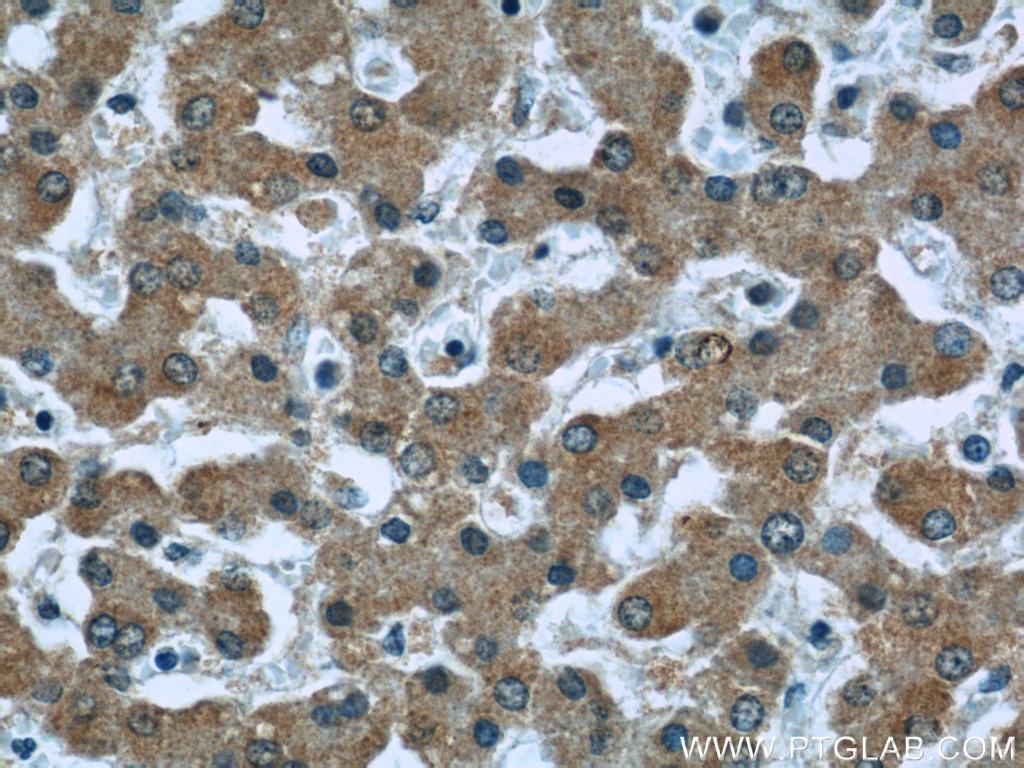 Immunohistochemistry (IHC) staining of human liver tissue using Caspase 8/p43/p18 Monoclonal antibody (66093-1-Ig)