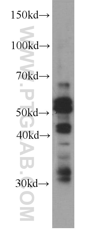 Western Blot (WB) analysis of HepG2 cells using Caspase 8/p43/p18 Monoclonal antibody (66093-1-Ig)