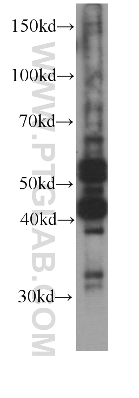 Western Blot (WB) analysis of HeLa cells using Caspase 8/p43/p18 Monoclonal antibody (66093-1-Ig)