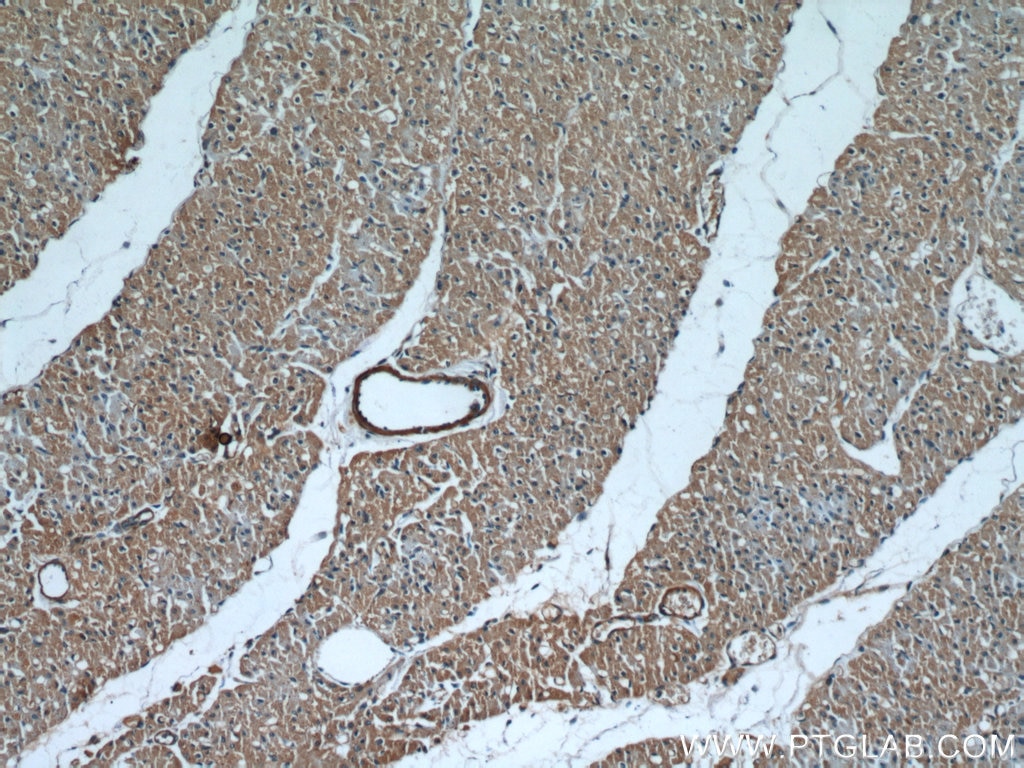 Immunohistochemistry (IHC) staining of human heart tissue using Caspase 9/p35/p10 Polyclonal antibody (10380-1-AP)