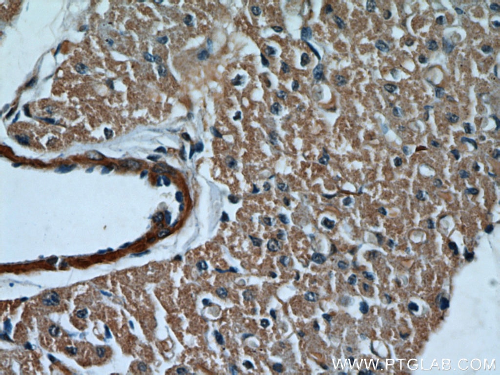 Immunohistochemistry (IHC) staining of human heart tissue using Caspase 9/p35/p10 Polyclonal antibody (10380-1-AP)