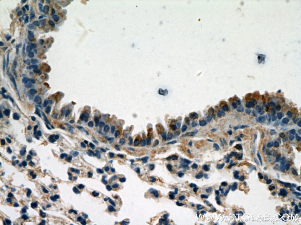 Immunohistochemistry (IHC) staining of mouse lung tissue using Caspase 9/p35/p10 Polyclonal antibody (10380-1-AP)