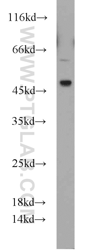 Western Blot (WB) analysis of HL-60 cells using Caspase 9/p35/p10 Polyclonal antibody (10380-1-AP)