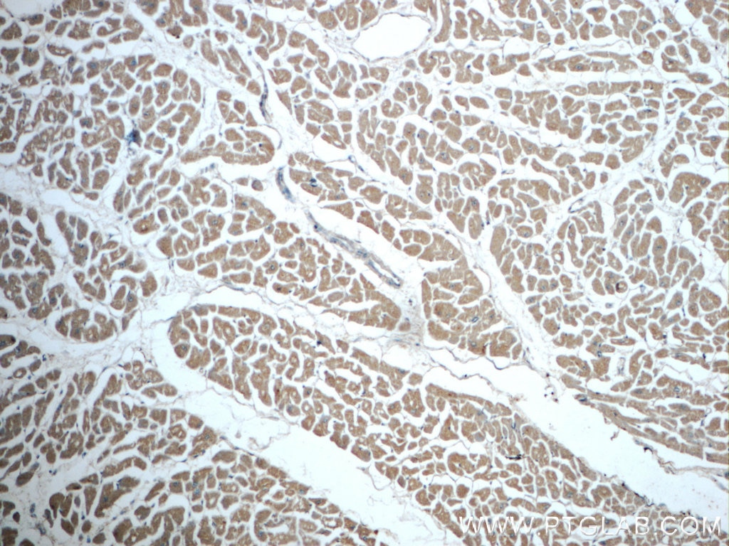 Immunohistochemistry (IHC) staining of human heart tissue using Caspase 9/p35/p10 Polyclonal antibody (23821-1-AP)