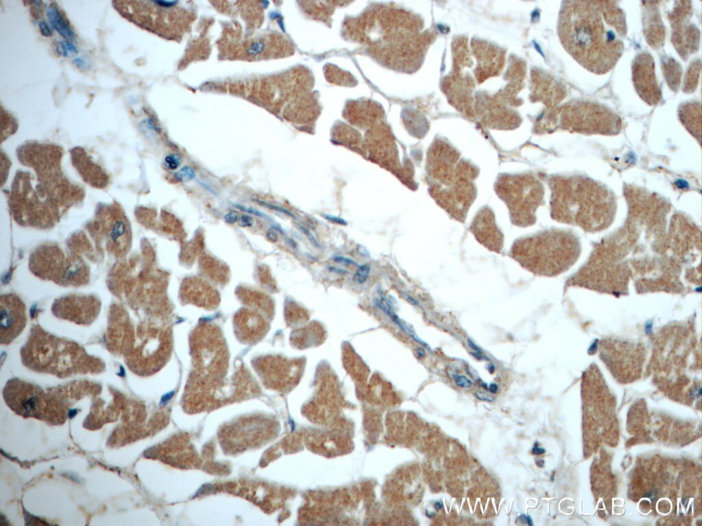 Immunohistochemistry (IHC) staining of human heart tissue using Caspase 9/p35/p10 Polyclonal antibody (23821-1-AP)