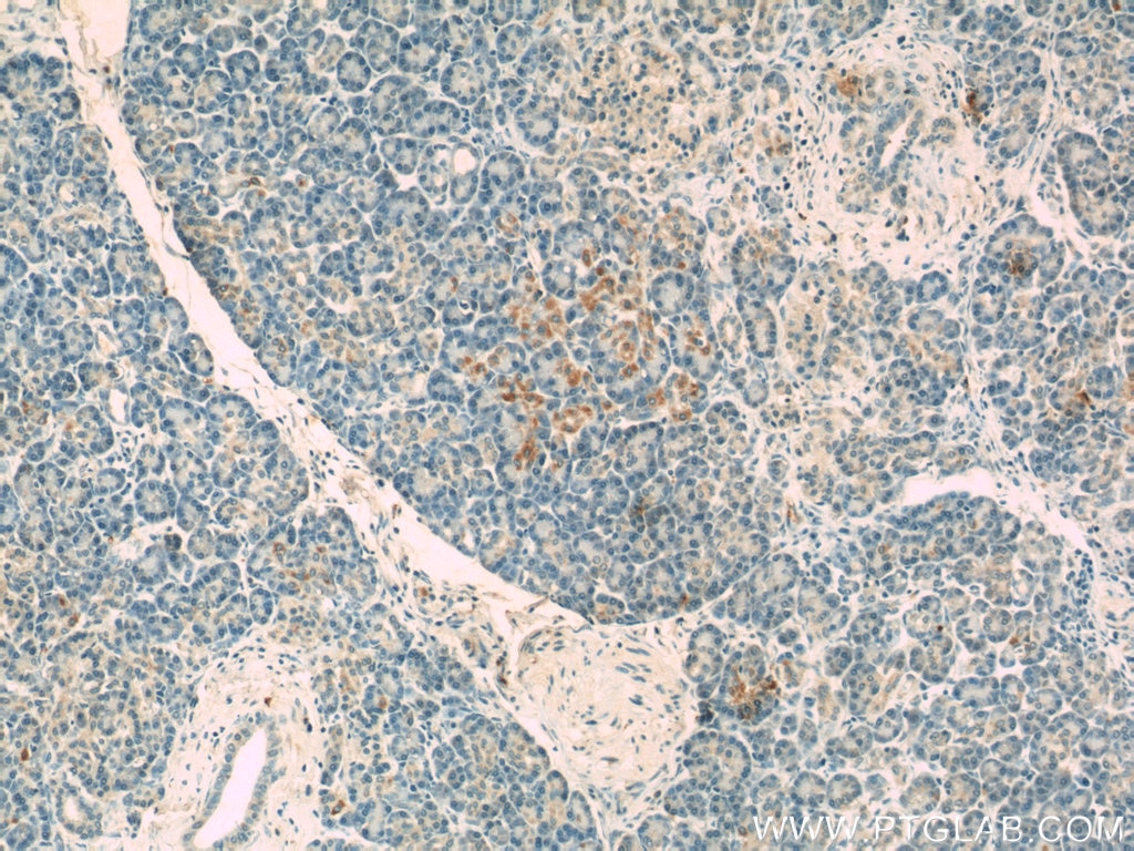 Immunohistochemistry (IHC) staining of human pancreas tissue using Caspase 9/p35/p10 Polyclonal antibody (23821-1-AP)