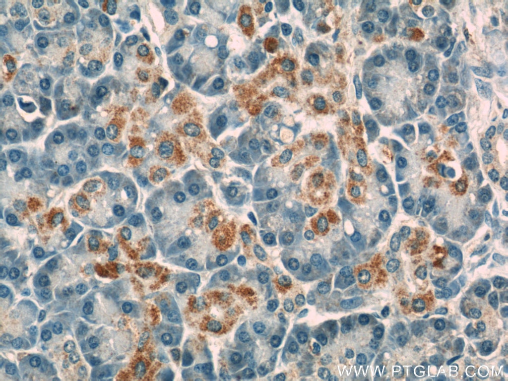 Immunohistochemistry (IHC) staining of human pancreas tissue using Caspase 9/p35/p10 Polyclonal antibody (23821-1-AP)