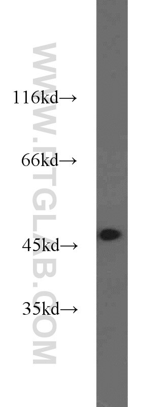 WB analysis of HeLa using 23821-1-AP