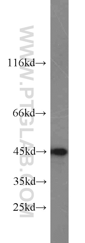 Western Blot (WB) analysis of HeLa cells using Caspase 9/p35/p10 Polyclonal antibody (23821-1-AP)