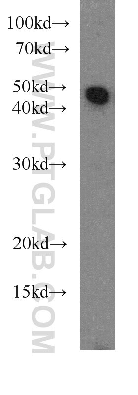 Western Blot (WB) analysis of UV treated Hela using Caspase 9/p35/p10 Polyclonal antibody (23821-1-AP)