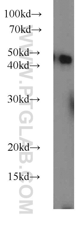 Western Blot (WB) analysis of UV treated Hela using Caspase 9/p35/p10 Polyclonal antibody (23821-1-AP)