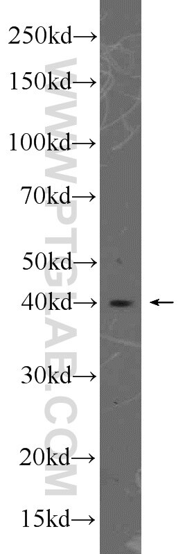 Western Blot (WB) analysis of HeLa cells using Caspase 9/p35/p10 Polyclonal antibody (23821-1-AP)