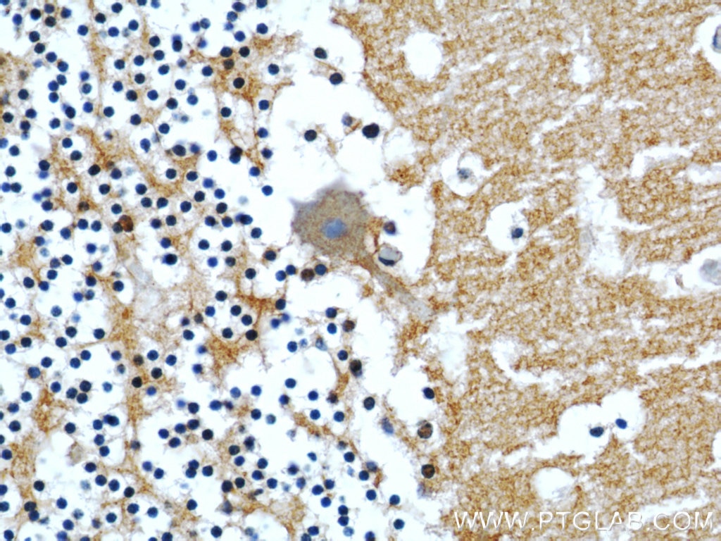 Immunohistochemistry (IHC) staining of human cerebellum tissue using CASPR Polyclonal antibody (55417-1-AP)