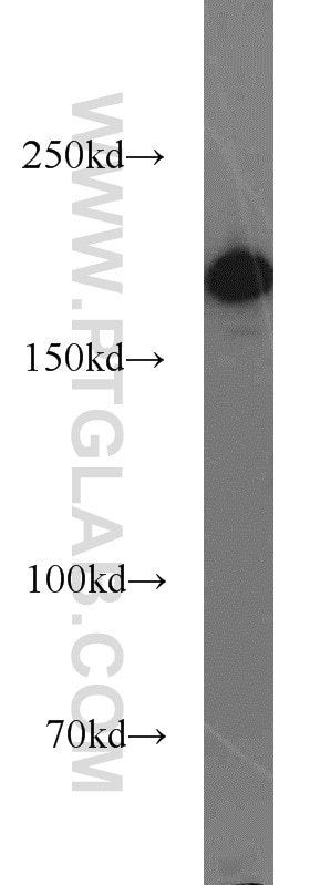 Western Blot (WB) analysis of mouse brain tissue using CASPR Polyclonal antibody (55417-1-AP)