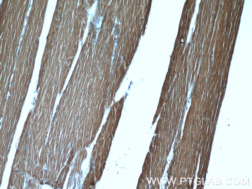 Immunohistochemistry (IHC) staining of human skeletal muscle tissue using Calsequestrin 1 Polyclonal antibody (16819-1-AP)