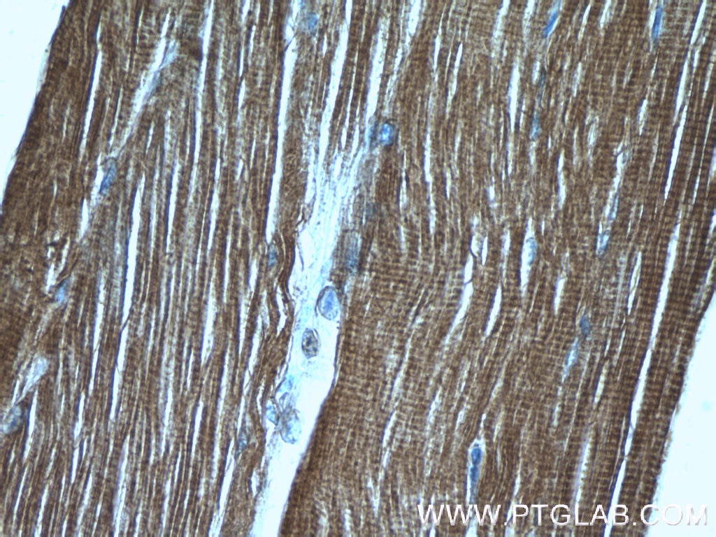 Immunohistochemistry (IHC) staining of human skeletal muscle tissue using Calsequestrin 1 Polyclonal antibody (16819-1-AP)