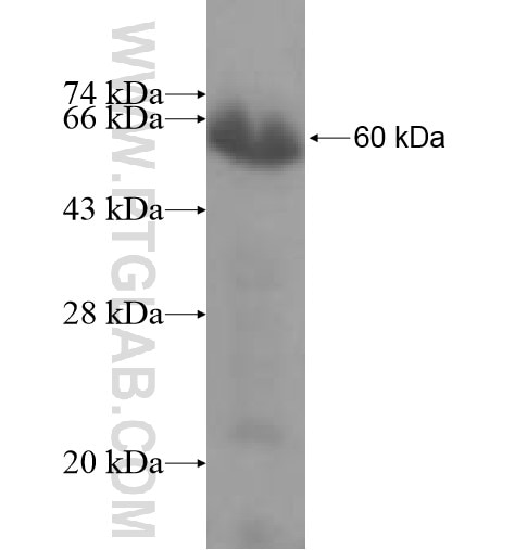CASQ1 fusion protein Ag10362 SDS-PAGE