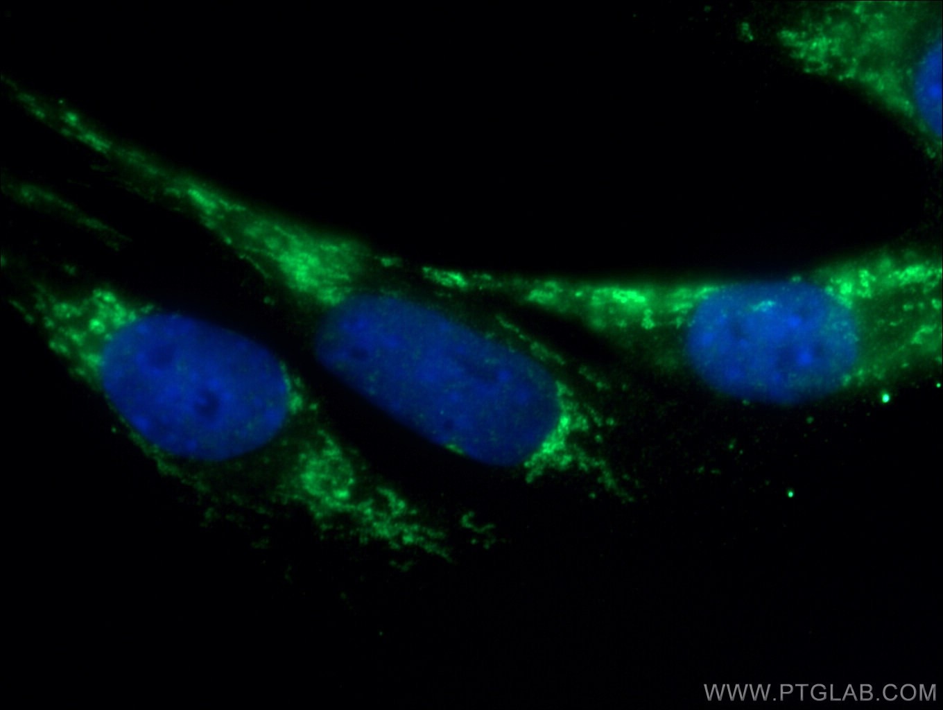 Immunofluorescence (IF) / fluorescent staining of C2C12 cells using Calsequestrin 2 Polyclonal antibody (18422-1-AP)