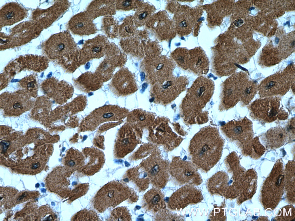 Immunohistochemistry (IHC) staining of human heart tissue using Calsequestrin 2 Polyclonal antibody (18422-1-AP)