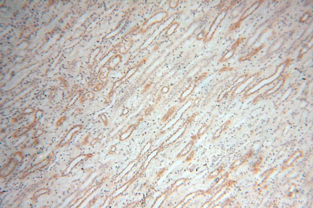 Immunohistochemistry (IHC) staining of human kidney tissue using Calsequestrin 2 Polyclonal antibody (18422-1-AP)