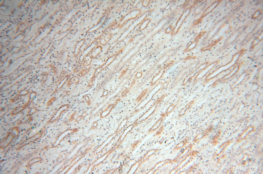 IHC staining of human kidney using 18422-1-AP