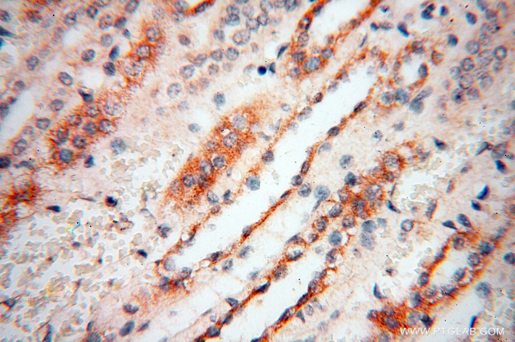 Immunohistochemistry (IHC) staining of human kidney tissue using Calsequestrin 2 Polyclonal antibody (18422-1-AP)