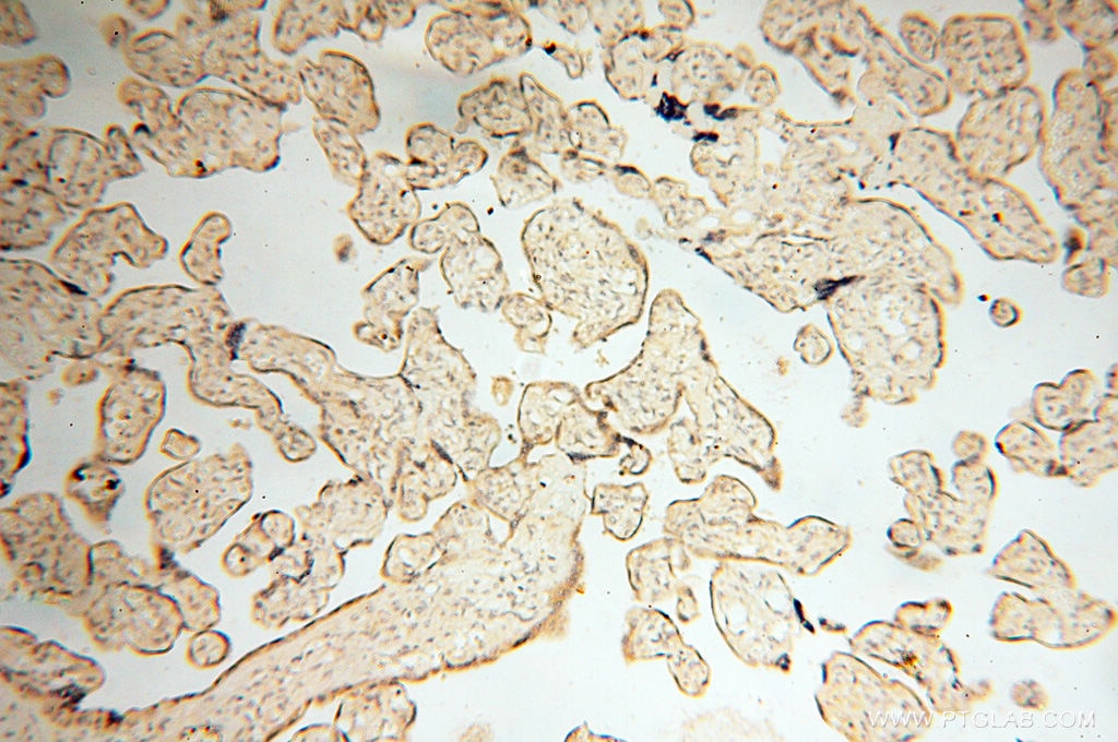 Immunohistochemistry (IHC) staining of human placenta tissue using Calsequestrin 2 Polyclonal antibody (18422-1-AP)