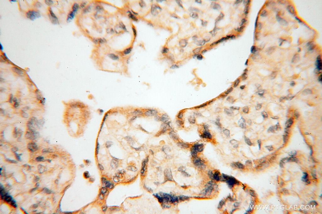 Immunohistochemistry (IHC) staining of human placenta tissue using Calsequestrin 2 Polyclonal antibody (18422-1-AP)