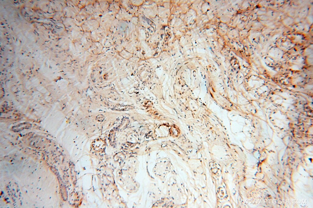 Immunohistochemistry (IHC) staining of human skin tissue using Calsequestrin 2 Polyclonal antibody (18422-1-AP)