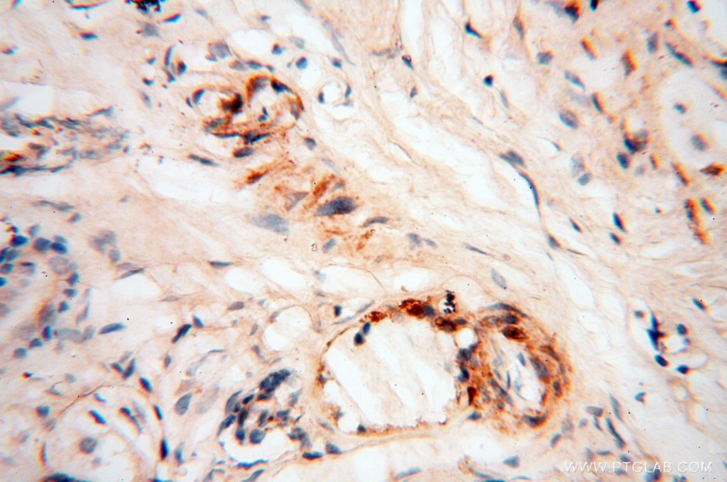 IHC staining of human skin using 18422-1-AP