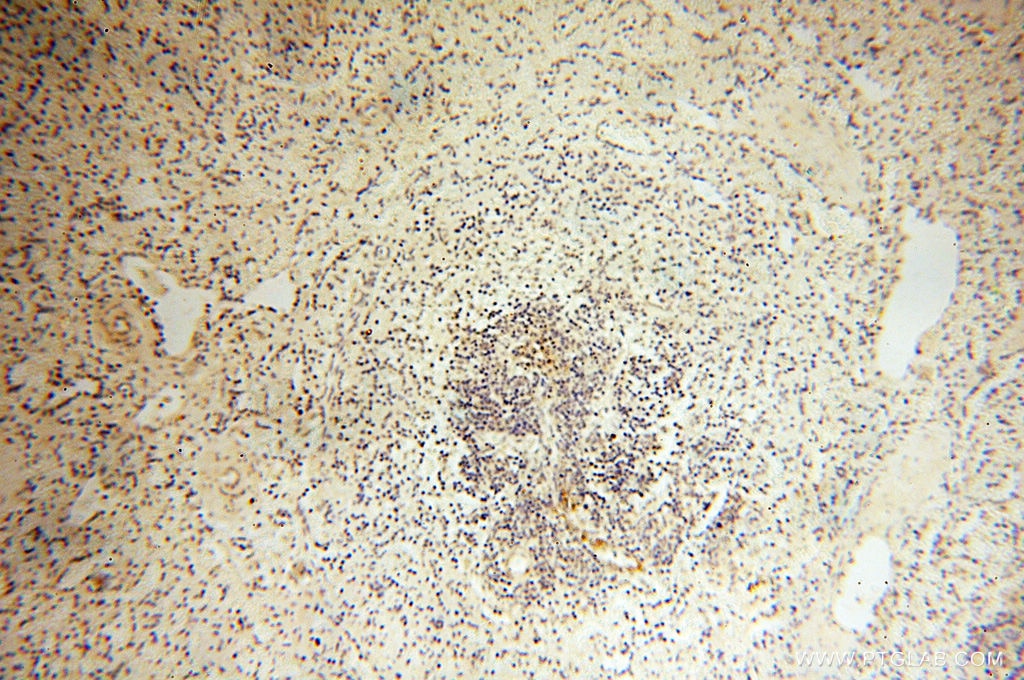 Immunohistochemistry (IHC) staining of human spleen tissue using Calsequestrin 2 Polyclonal antibody (18422-1-AP)