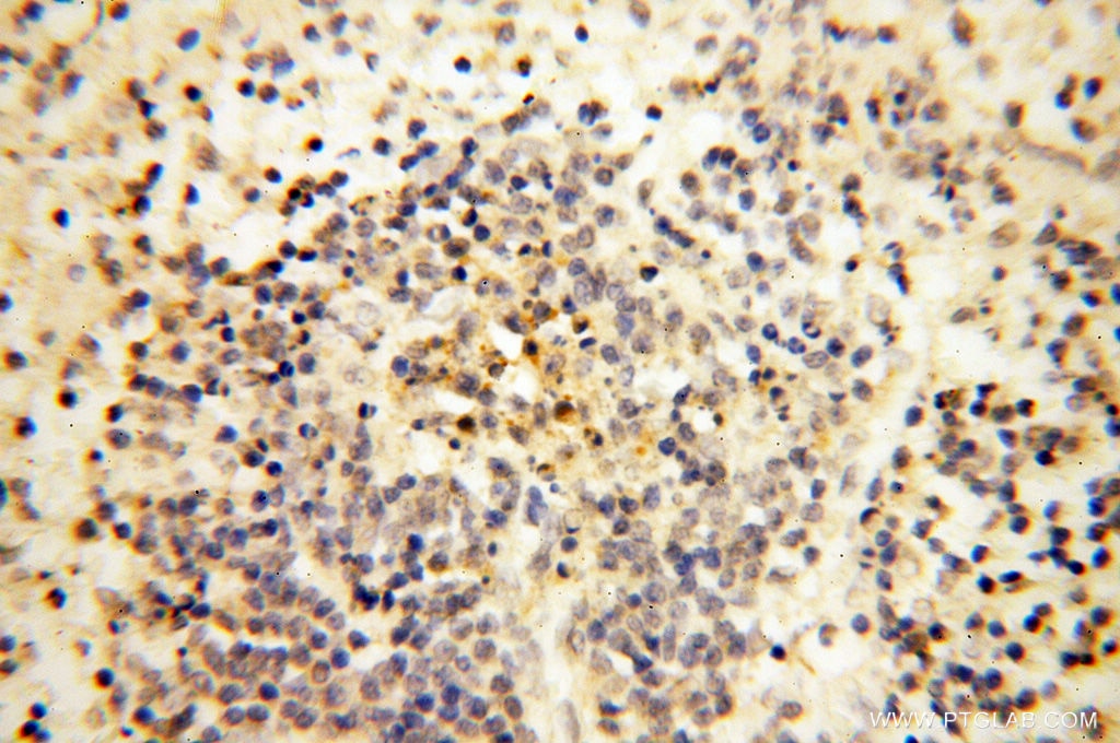 Immunohistochemistry (IHC) staining of human spleen tissue using Calsequestrin 2 Polyclonal antibody (18422-1-AP)