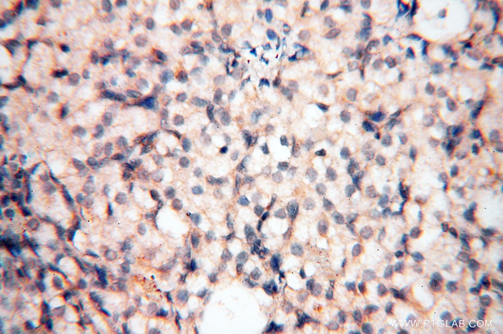 Immunohistochemistry (IHC) staining of human ovary tissue using Calsequestrin 2 Polyclonal antibody (18422-1-AP)